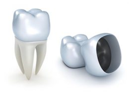 روکش دندان [object object] مراقبت های پس از درمان ریشه 84 260x185  مطالب دندانپزشکی 84 260x185