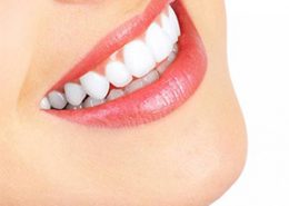 [object object] مراقبت های پس از درمان ریشه arasteh 260x185  مطالب دندانپزشکی arasteh 260x185