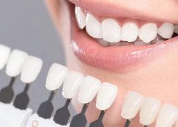 روکش دندان کلینیک دندانپزشکی آراسته [object object] مراقبت های پس از درمان ریشه 4 260x185  مطالب دندانپزشکی 4 260x185