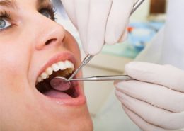 کلینیک دندانپزشکی آرسته [object object] مراقبت های پس از درمان ریشه 10 260x185  مطالب دندانپزشکی 10 260x185