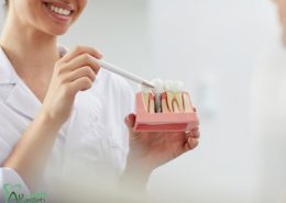 دندانپزشکی آرسته در شیراز [object object] مراقبت های پس از درمان ریشه 3 260x185  مطالب دندانپزشکی 3 260x185