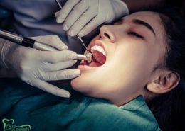 دندانپزشکی آرسته در شیراز [object object] مراقبت های پس از درمان ریشه 11 260x185  مطالب دندانپزشکی 11 260x185