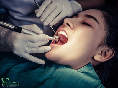 دندانپزشکی آرسته در شیراز جراحی دندان در شیراز جراحی دندان 11