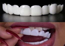 [object object] مراقبت های پس از درمان ریشه snap 260x185  مطالب دندانپزشکی snap 260x185