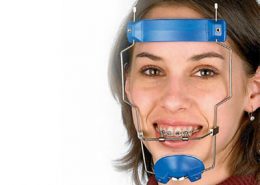 فیس ماسک ارتودنسی چیست [object object] مراقبت های پس از درمان ریشه 400 260x185  مطالب دندانپزشکی 400 260x185