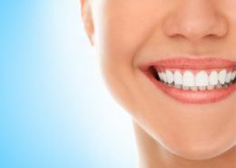 [object object] مراقبت های پس از درمان ریشه laminiate 260x185  مطالب دندانپزشکی laminiate 260x185