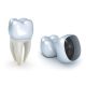 روکش دندان مراقبت های پس از ترمیم دندان مراقبت های پس از ترمیم دندان 84 80x80