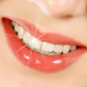 سفیدکردن دندان  چرا سلامت دندان اهمیت دارد؟ cosmetic dentistry 80x80