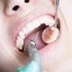 ترمیم دندان کلینیک دندانپزشکی آراسته شیراز  اشتباهات هنگام مسواک زدن 1 80x80