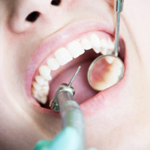 ترمیم دندان کلینیک دندانپزشکی آراسته شیراز  انواع روش های ترمیم دندان 1