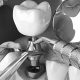 کاشت موفق ایمپلنت دندانپزشکی آراسته  سه چالش پیش رو در انجام ونیر و راه حل مقابله با آن ها 3 80x80