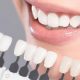 روکش دندان کلینیک دندانپزشکی آراسته  بهترین مسکن برای کودکان در طی درمان های دندانپزشکی 4 80x80