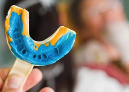 کلینیک دندانپزشکی آراسته [object object] مراقبت های پس از درمان ریشه 6 260x185  مطالب دندانپزشکی 6 260x185