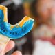 کلینیک دندانپزشکی آراسته  بهترین مسکن برای کودکان در طی درمان های دندانپزشکی 6 80x80