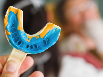 کلینیک دندانپزشکی آراسته  8 قانون طلایی برای قالبگیری 6