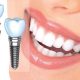 کلینیک دندانپزشکی آراسته  بلیچینگ و سفید کردن دندان 8 80x80