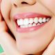 کلینیک دندانپزشکی آراسته  کشیدن دندان عقل 9 80x80