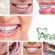 کلینیک دندانپزشکی آرسته  سفید کردن دندان (بلیچینگ) 13 80x80