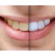 کلینیک دندانپزشکی آرسته  تاثیرات سیگار بر دندان 14 80x80