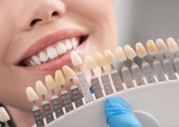 کلینیک تخصصی دندانپزشکی آرسته [object object] مراقبت های پس از درمان ریشه 16 260x185  مطالب دندانپزشکی 16 260x185