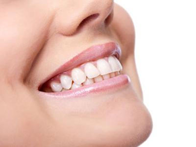 کلینیک دندانپزشکی آرسته  لمینت دندان 18