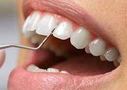 کلینیک تخصصی دندانپزشکی آرسته [object object] مراقبت های پس از درمان ریشه 20 260x185  مطالب دندانپزشکی 20 260x185