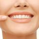 کلینیک تخصصی دندانپزشکی آرسته  آیا جرم گیری باعث صدمه به دندان ها می شود؟ 41 80x80