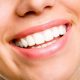 کلینیک دندانپزشکی آرسته  آیا می توان برای رفع کجی دندان از درمان لمینت دندان استفاده کرد؟ 21 80x80