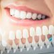 کلینیک دندانپزشکی آرسته  4 عاملی که باعث خرابی زودرس دندان هایتان می شود ؟ 22 80x80
