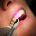دندانپزشکی آرسته در شیراز  جراحی لثه با لیزر 30 36x36