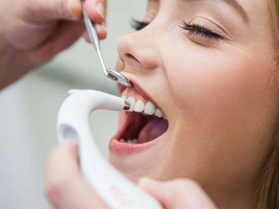 دندانپزشکی آرسته در شیراز  سفید کردن دندان با لیزر 32