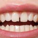 دندانپزشکی آرسته در شیراز مشکلات دهان و دندان 4 مورد از مشکلات دندانی که باید بدانید 53 80x80