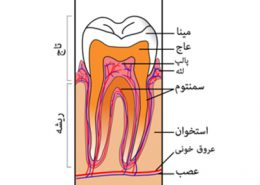 دندانپزشکی آرسته در شیراز [object object] مراقبت های پس از درمان ریشه 63 260x185  مطالب دندانپزشکی 63 260x185