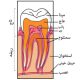 دندانپزشکی آرسته در شیراز آفت دهان آفت دهان چیست 63 80x80