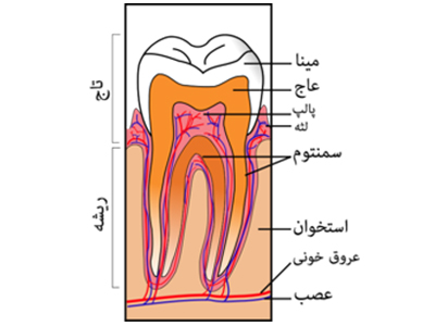 دندانپزشکی آرسته در شیراز عاج دندان عاج دندان چیست 63