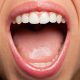 دندانپزشکی آرسته در شیراز دلایل ایجاد بوی بد دهان دلایل ایجاد بوی بد دهان 69 80x80