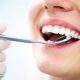 دندانپزشکی آرسته در شیراز جراحی دندان در شیراز جراحی دندان 14 80x80