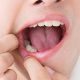 دندانپزشکی آرسته در شیراز عفونت دندان عفونت دندان 74 80x80