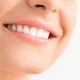 دندانپزشکی آرسته در شیراز پلاک دندان پلاک دندان 77 80x80