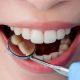 دندانپزشکی آرسته در شیراز کاندیدای مناسب لمینت دندان کاندیدای مناسب لمینت دندان 78 80x80