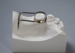 فضا نگه دار چیست [object object] مراقبت های پس از درمان ریشه Untitled 1 1 260x185  مطالب دندانپزشکی Untitled 1 1 260x185