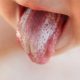 برفک دهان چیست سایش سایش شیمیایی دندان ها Untitled 80x80