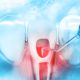درمان ایمپلنت با لیزر لمینت دندان روکش ایمکس دندان Untitled 1 1 80x80