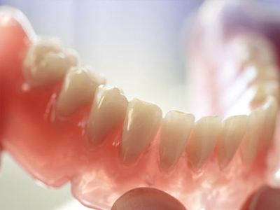 فاکتور های موثر در تعیین نوع پروتز پروتز دندان فاکتور های موثر در تعیین نوع پروتز Untitled 1 1