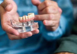 در چه شرایطی نمی توان درمان ایمپلنت دندان را انجام داد [object object] مراقبت های پس از درمان ریشه Untitled 1 260x185  مطالب دندانپزشکی Untitled 1 260x185