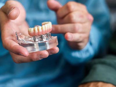 در چه شرایطی نمی توان درمان ایمپلنت دندان را انجام داد لمینت دندان ضخامت لمینت دندان Untitled 1