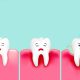 التهاب لثه  لمینیت سرامیکی دندان دقیقا چه کاربردی دارد و چه مشکلاتی را برطرف می ‌کند؟ Eltehablase Arasteh 80x80
