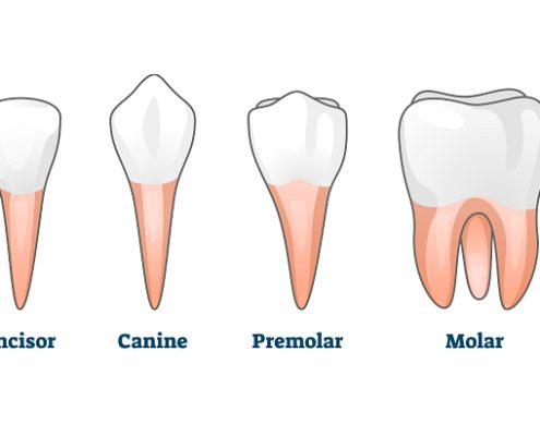 انواع دندان  چه کسانی به بیماری لثه مبتلا می شوند؟ anvadandan Arasteh 495x400
