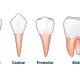 انواع دندان  سن مناسب اقدام به ایمپلنت anvadandan Arasteh 80x80