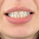 نکاتی برای انتخاب یک خمیر دندان خوب White spots 80x80